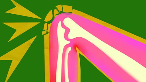 Здрави Колене (Zdravi Kolene)
